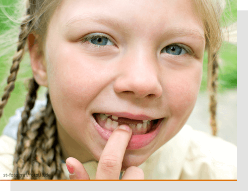 Zahnlcken bei Kindern ausgleichen